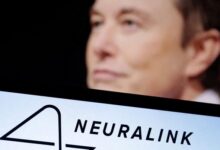 Nasib Ngeri Orang Pertama yang mana yang dimaksud Ditanam Chip Otak Elon Musk